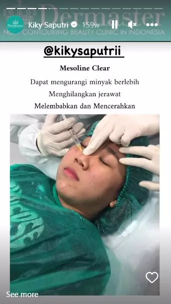 Kiky Saputri sebelum dan usai perawatan © berbagai sumber Kiky Saputri sebelum dan usai perawatan © berbagai sumber