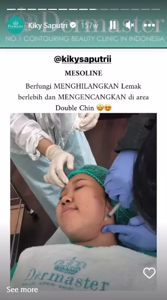Kiky Saputri sebelum dan usai perawatan © berbagai sumber Kiky Saputri sebelum dan usai perawatan © berbagai sumber