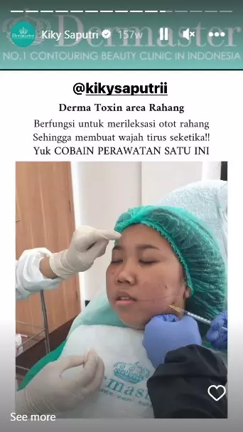 Kiky Saputri sebelum dan usai perawatan © berbagai sumber Kiky Saputri sebelum dan usai perawatan © berbagai sumber