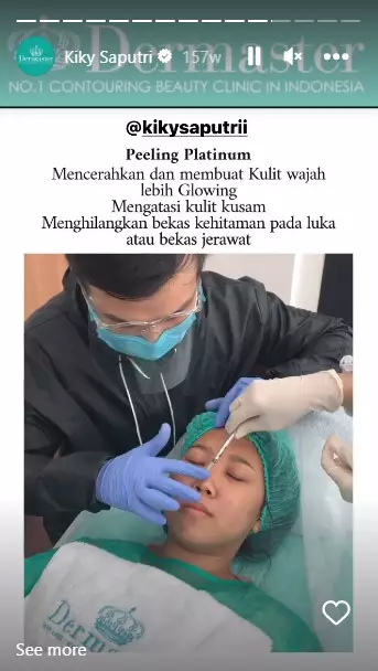 Kiky Saputri sebelum dan usai perawatan © berbagai sumber Kiky Saputri sebelum dan usai perawatan © berbagai sumber