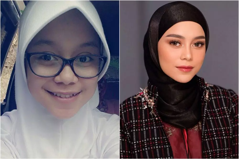 lesti before after perawatan © Instagram lesti before after perawatan © Instagram