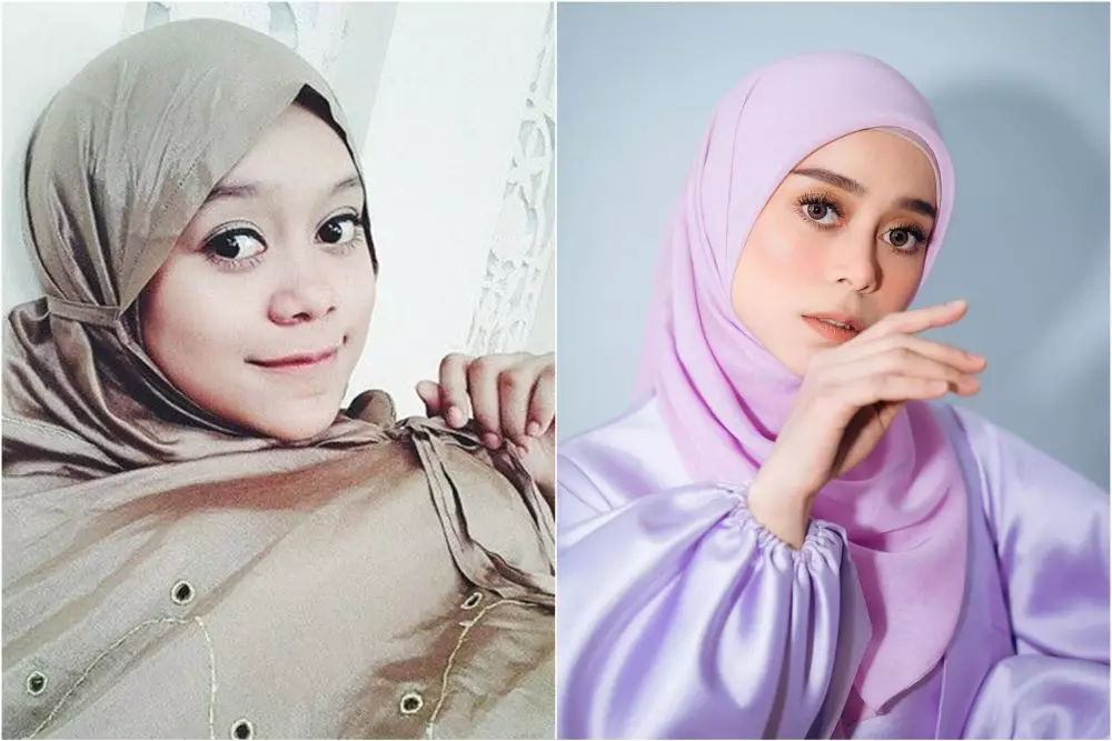 lesti before after perawatan © Instagram lesti before after perawatan © Instagram