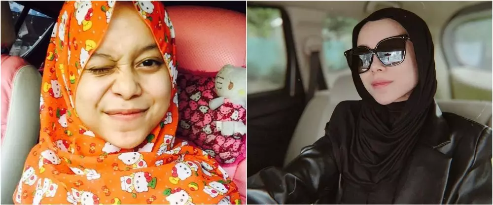 lesti before after perawatan © Instagram lesti before after perawatan © Instagram