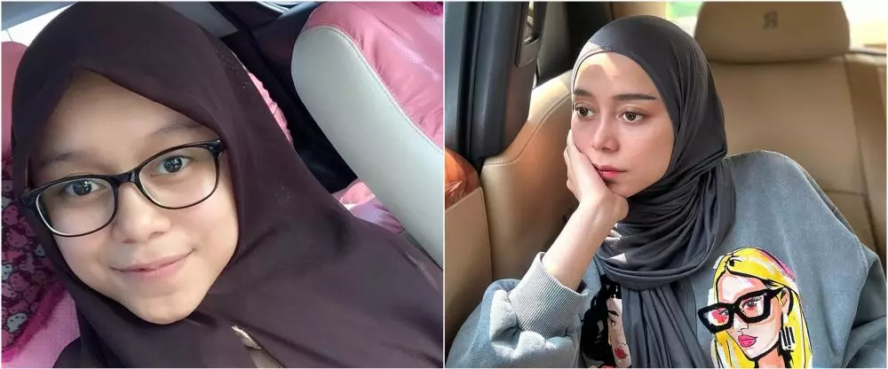 lesti before after perawatan © Instagram lesti before after perawatan © Instagram