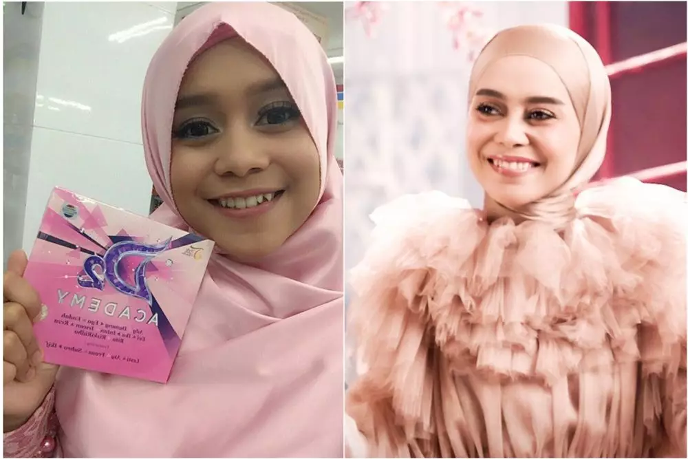 lesti before after perawatan © Instagram lesti before after perawatan © Instagram