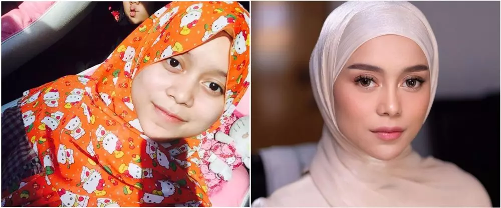 lesti before after perawatan © Instagram lesti before after perawatan © Instagram