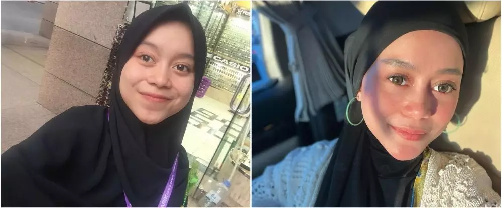 lesti before after perawatan © Instagram lesti before after perawatan © Instagram
