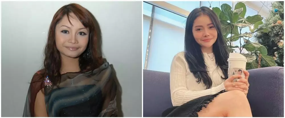 mawar afi sebelum dan sesudah operasi plastik © berbagai sumber mawar afi sebelum dan sesudah operasi plastik © berbagai sumber