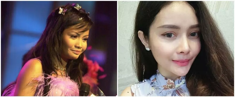 mawar afi sebelum dan sesudah operasi plastik © berbagai sumber mawar afi sebelum dan sesudah operasi plastik © berbagai sumber