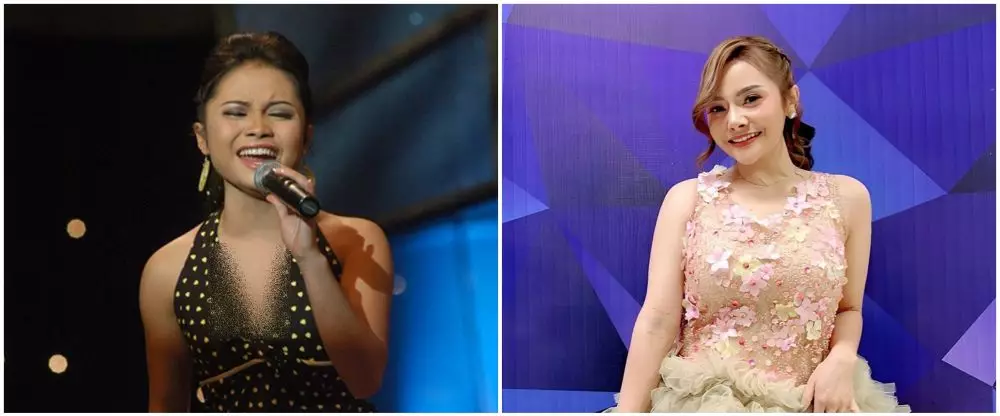 mawar afi sebelum dan sesudah operasi plastik © berbagai sumber mawar afi sebelum dan sesudah operasi plastik © berbagai sumber