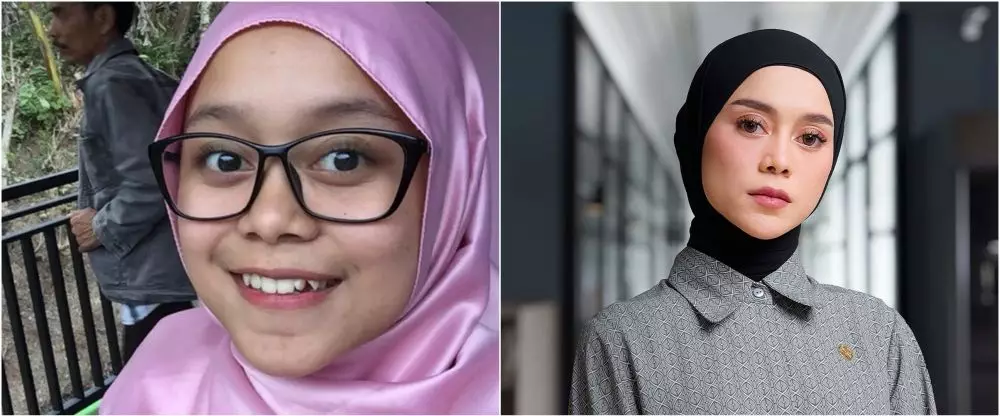 potret pedangdut sebelum dan sesudah tanam benang © berbagai sumber potret pedangdut sebelum dan sesudah tanam benang © berbagai sumber