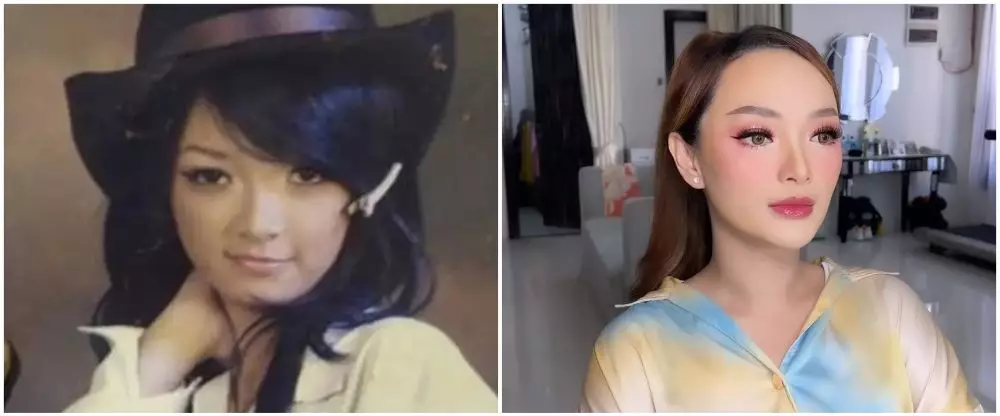 potret pedangdut sebelum dan sesudah tanam benang © berbagai sumber potret pedangdut sebelum dan sesudah tanam benang © berbagai sumber