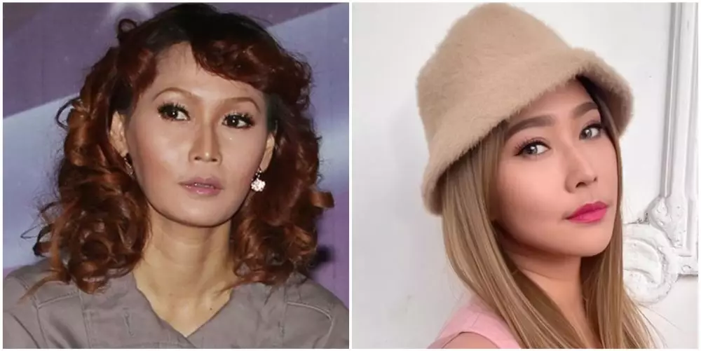 potret pedangdut sebelum dan sesudah tanam benang © berbagai sumber potret pedangdut sebelum dan sesudah tanam benang © berbagai sumber