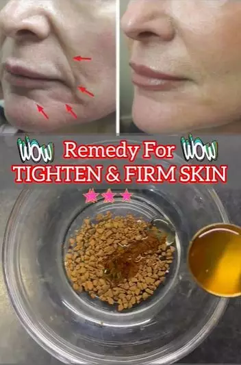 Cegah kulit mengendur dan cepat keriput Berbagai sumber