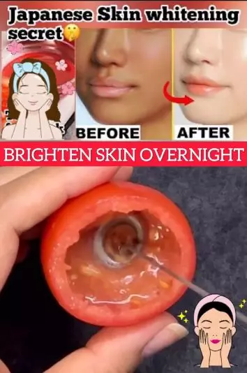 Mencerahkan wajah kusam dan sulit putih Berbagai sumber