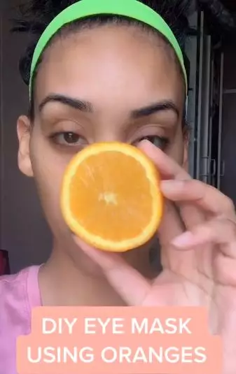 Pudarkan kantung mata hitam pakai jeruk Berbagai sumber