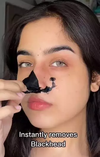 Hempas komedo hitam di area hidung Berbagai sumber