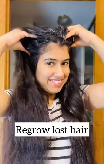 Lebatkan rambut tipis dan mudah rontok Berbagai sumber