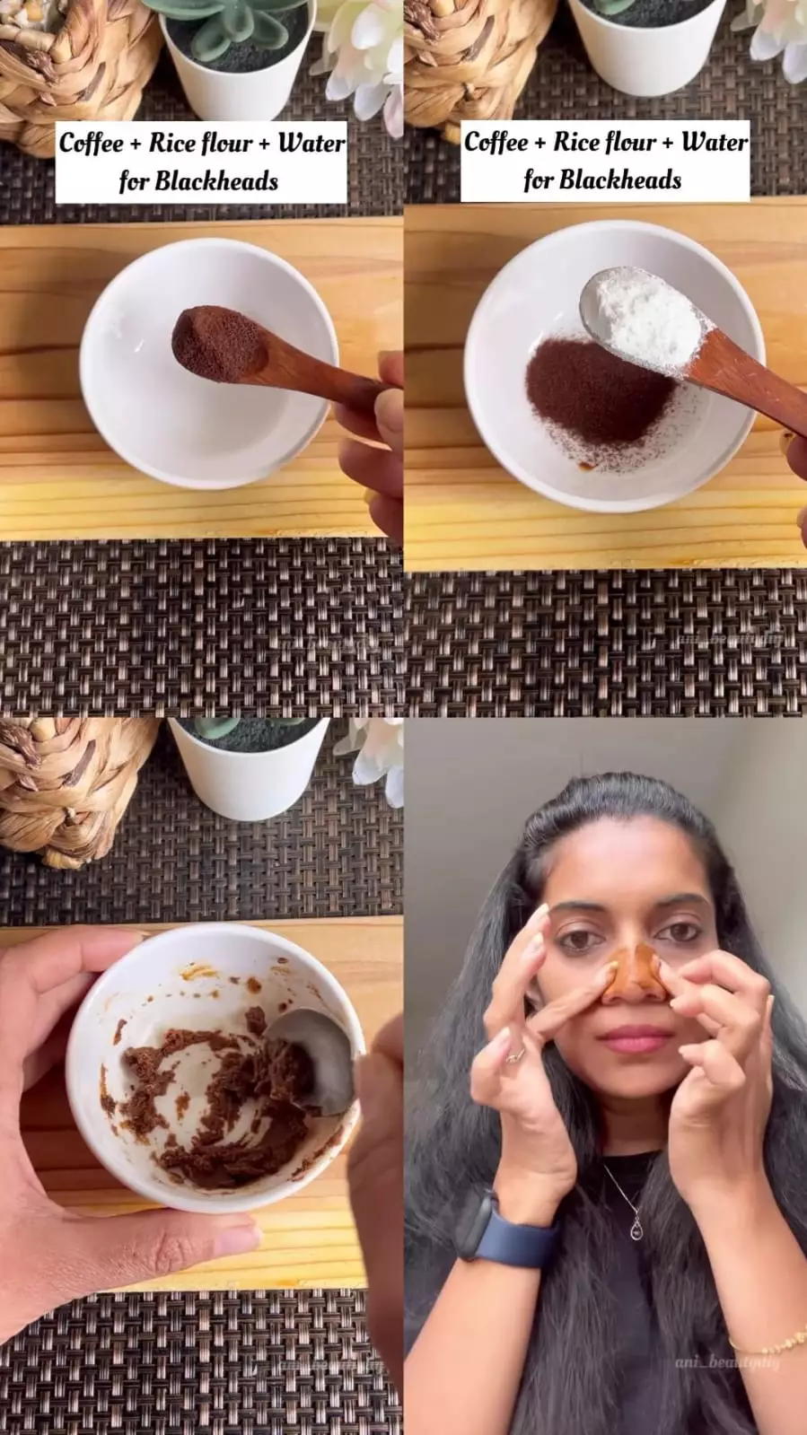 pori besar dan komedo di hidung © Instagram