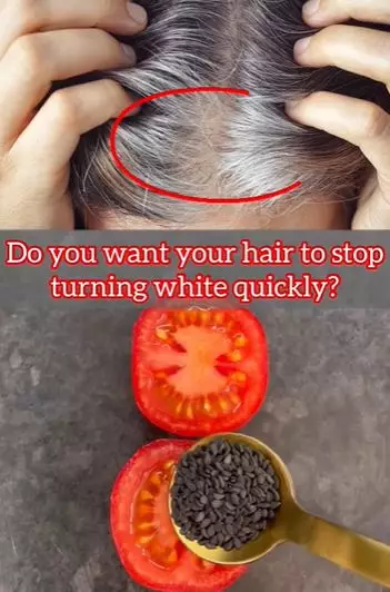 Memperlambat tumbuhnya uban pakai wijen Berbagai sumber Memperlambat tumbuhnya uban pakai wijen Berbagai sumber