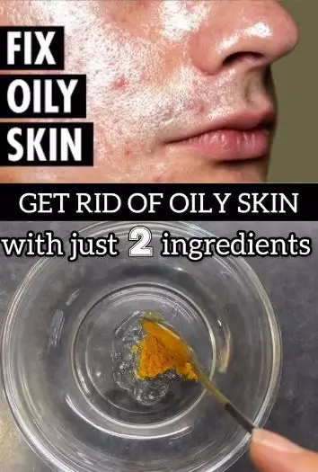 Atasi wajah berminyak dan mudah berkomedo Berbagai sumber