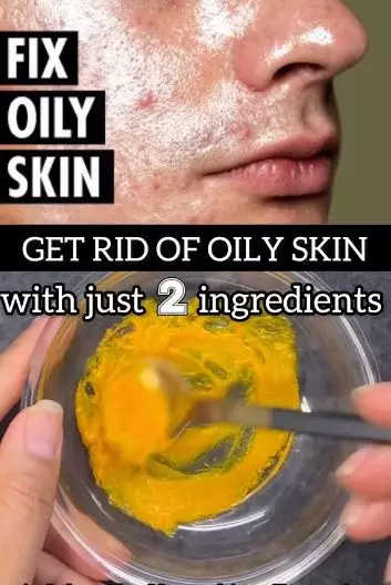 Atasi wajah berminyak dan mudah berkomedo Berbagai sumber