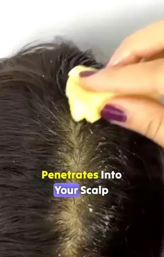 Mencegah uban tumbuh lebih banyak dengan 1 produk bayi Berbagai sumber