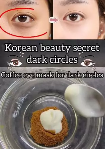 Atasi kantung mata hitam dan berkerut Berbagai sumber