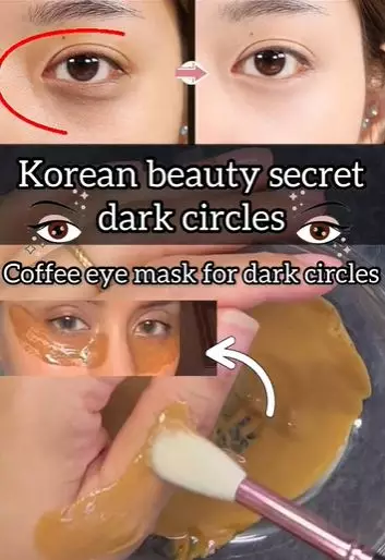 Atasi kantung mata hitam dan berkerut Berbagai sumber