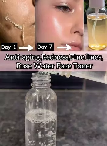 Cegah munculnya keriput pakai toner cengkeh Berbagai sumber Cegah munculnya keriput pakai toner cengkeh Berbagai sumber