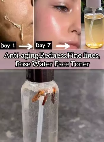 Cegah munculnya keriput pakai toner cengkeh Berbagai sumber Cegah munculnya keriput pakai toner cengkeh Berbagai sumber