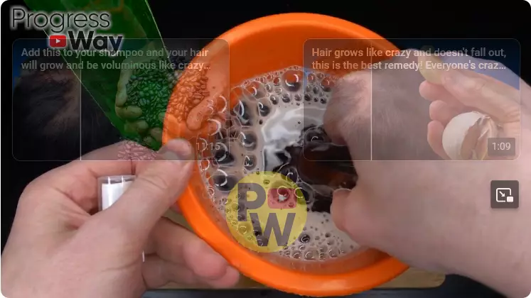 bersihkan kulit kepala dari ketombe berbagai sumber