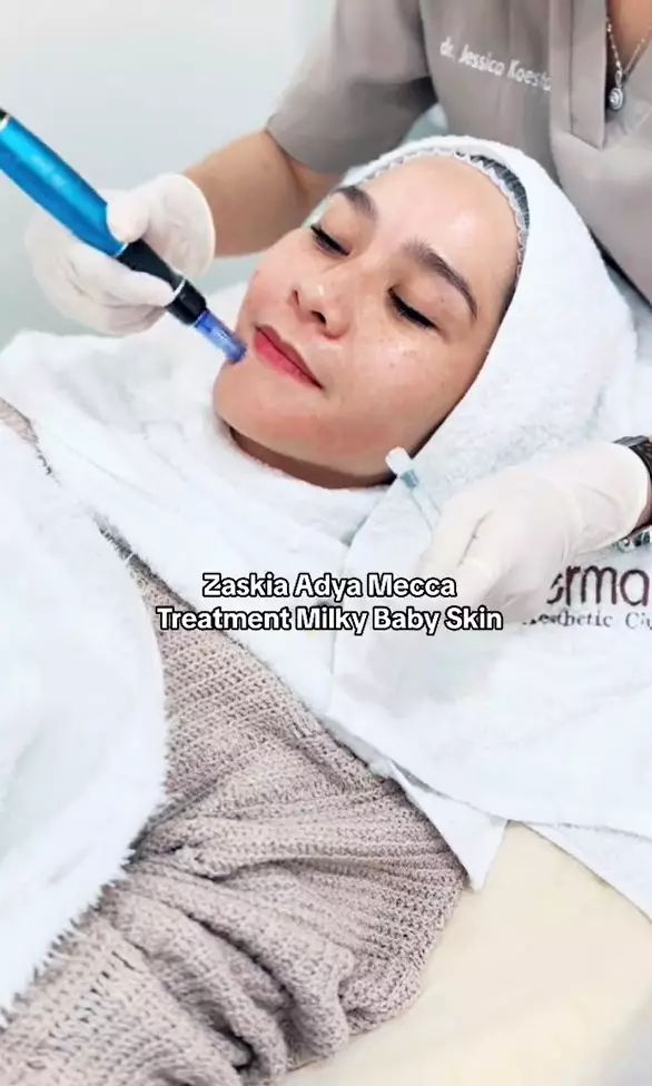 Potret seleb tampil polos saat perawatan wajah curi atensi © berbagai sumber Potret seleb tampil polos saat perawatan wajah curi atensi © berbagai sumber