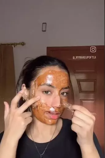 Angkat komedo hitam dan putih di hidung Berbagai sumber Angkat komedo hitam dan putih di hidung Berbagai sumber