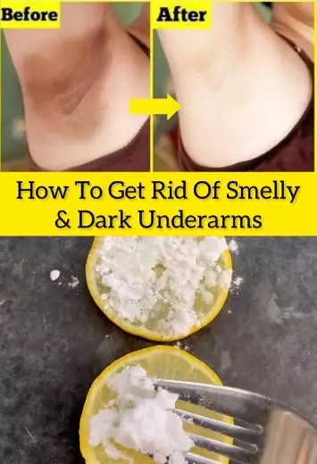 Atasi ketiak bau dan menghitam Berbagai sumber