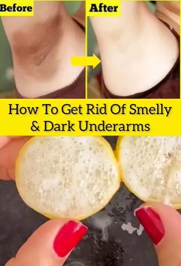 Atasi ketiak bau dan menghitam Berbagai sumber