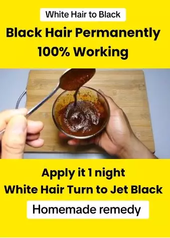 Atasi uban prematur agar kembali hitam Berbagai sumber