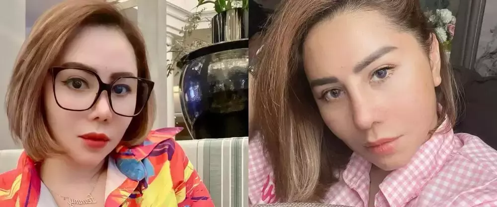 seleb lakukan operasi hidung di Korea © berbagai sumber