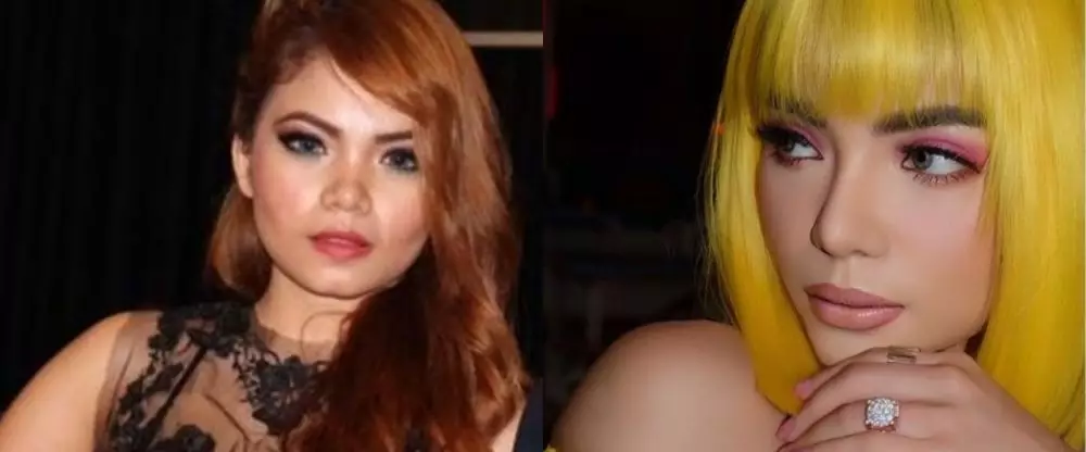 seleb lakukan operasi hidung di Korea © berbagai sumber