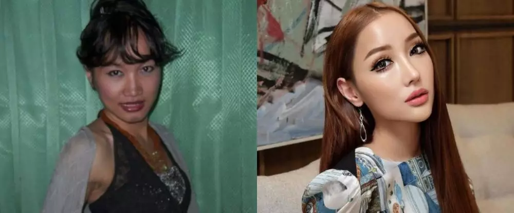 seleb lakukan operasi hidung di Korea © berbagai sumber