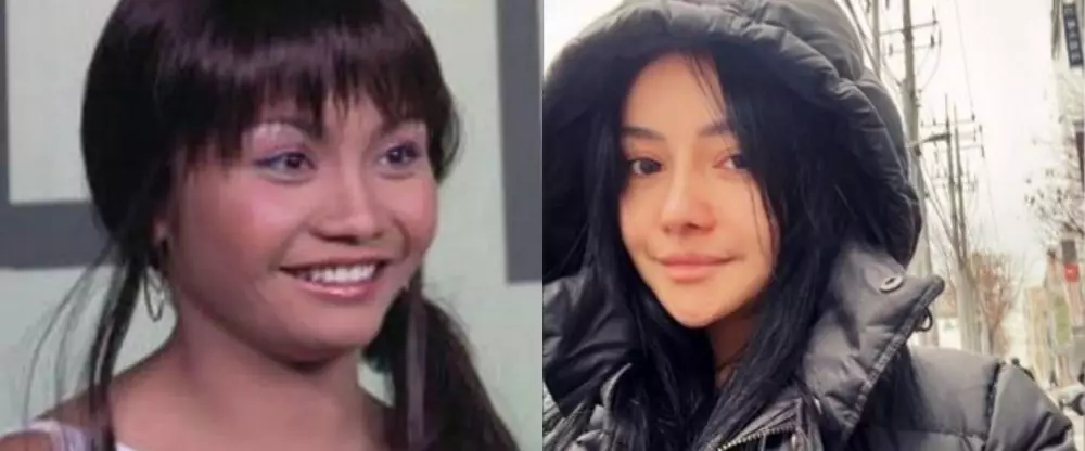 seleb lakukan operasi hidung di Korea © berbagai sumber