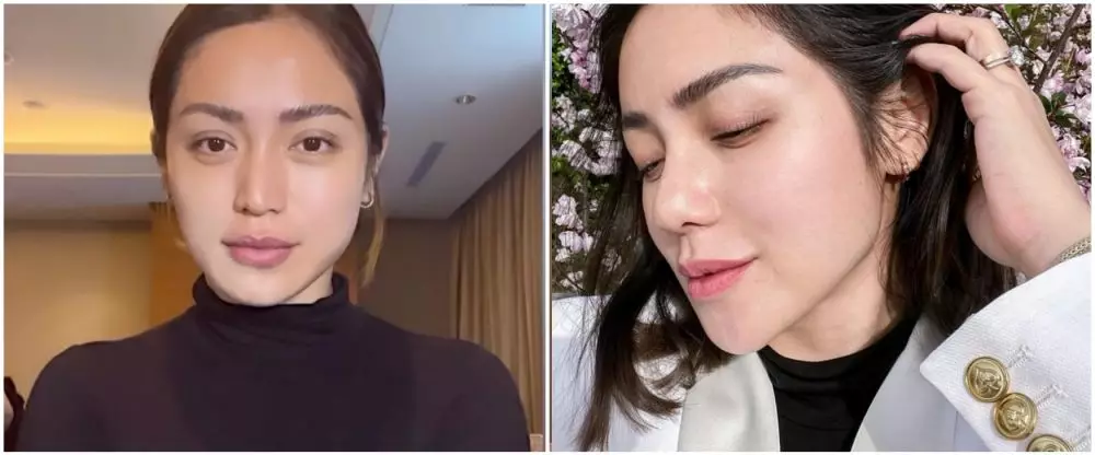 seleb lakukan operasi hidung di Korea © berbagai sumber