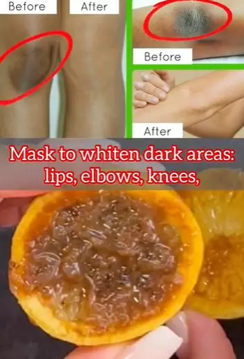 Bikin scrub pemutih siku dan lutut Berbagai sumber