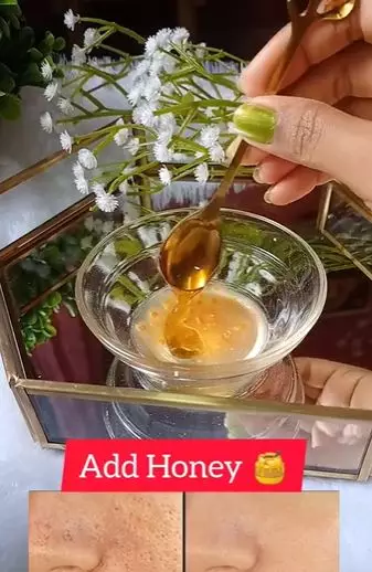 Mengatasi pori-pori tersumbat dengan madu Berbagai sumber Mengatasi pori-pori tersumbat dengan madu Berbagai sumber