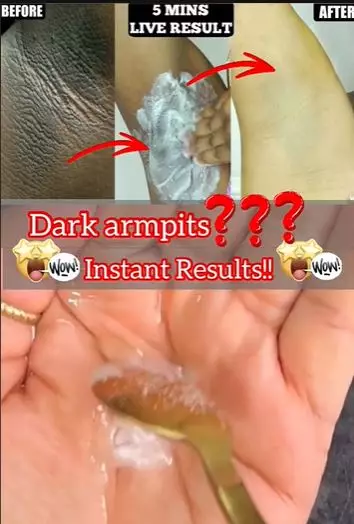 Cerahkan ketiak hitam dan bau tidak sedap pakai minyak kelapa Berbagai sumber