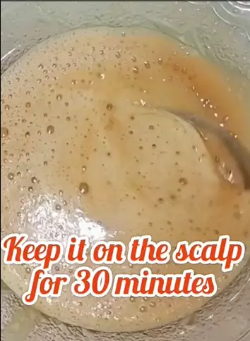 atasi rambut rontok berbagai sumber