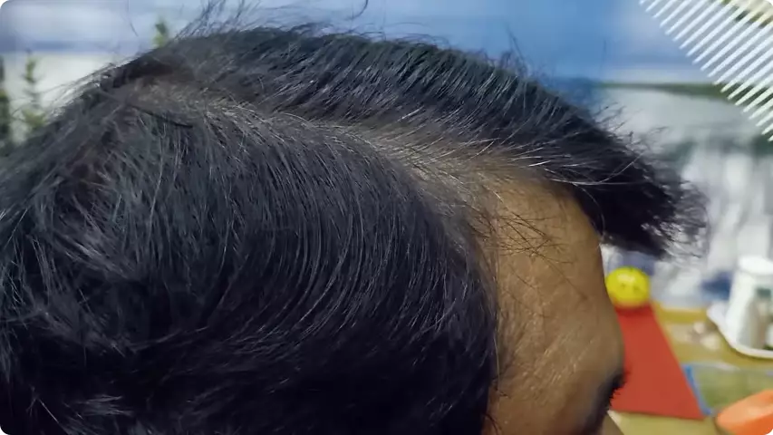 tutupi rambut beruban pakai kopi berbagai sumber