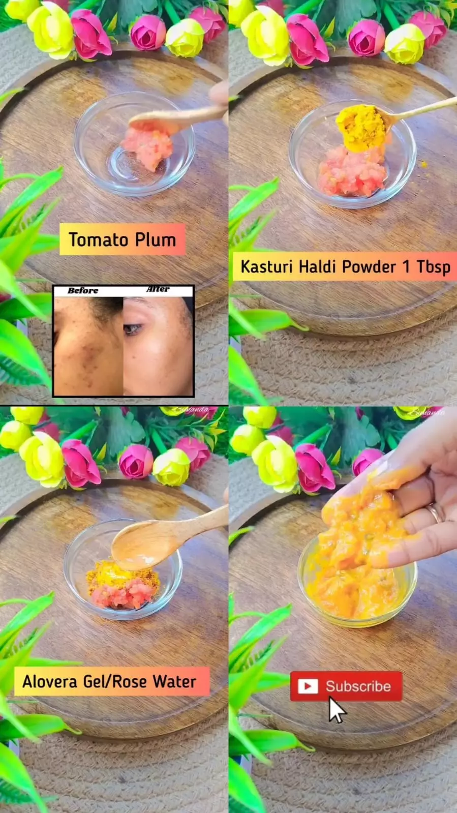 Tanpa IPL Treatment © Instagram