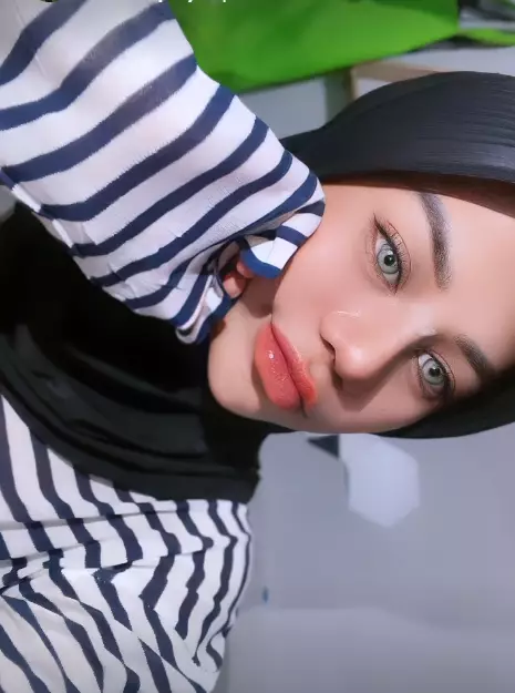 Potret terbaru Cimoy Montok usai oplas hidung © 2023 brilio.net