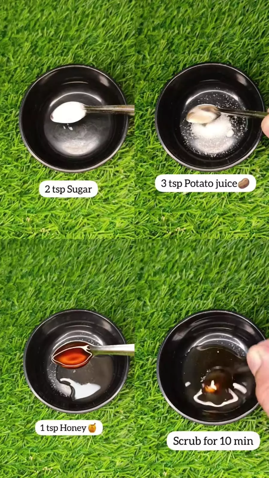 berlebih di wajah berminyak © Instagram